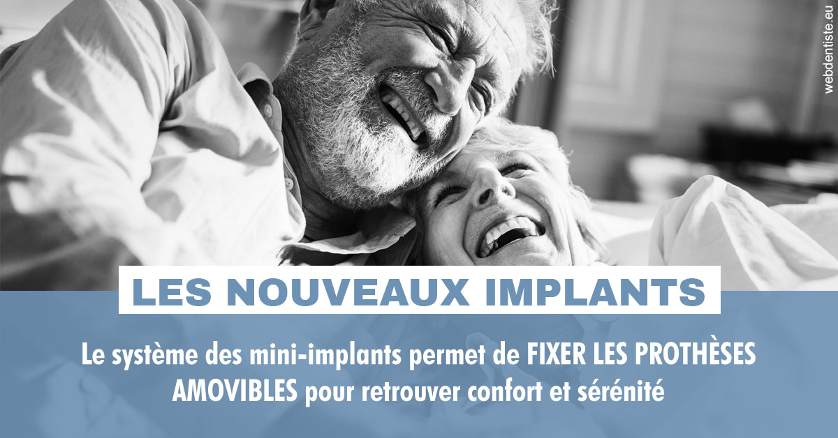 https://scp-chirurg-dentiste-drs-levy-nataf.chirurgiens-dentistes.fr/Les nouveaux implants 2