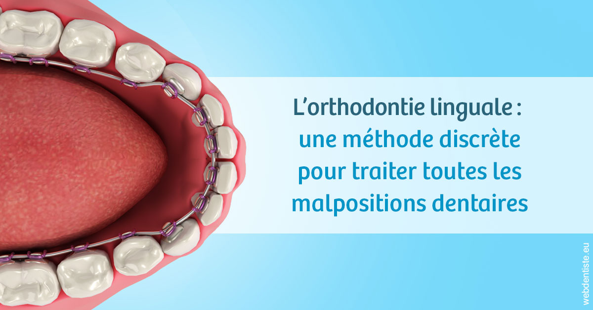 https://scp-chirurg-dentiste-drs-levy-nataf.chirurgiens-dentistes.fr/L'orthodontie linguale 1