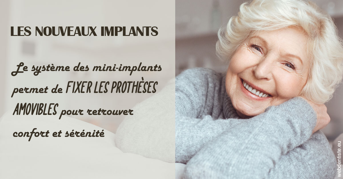 https://scp-chirurg-dentiste-drs-levy-nataf.chirurgiens-dentistes.fr/Les nouveaux implants 1