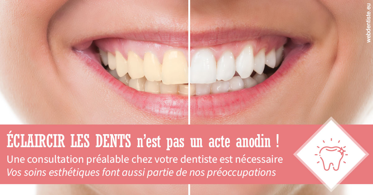 https://scp-chirurg-dentiste-drs-levy-nataf.chirurgiens-dentistes.fr/Eclaircir les dents 1
