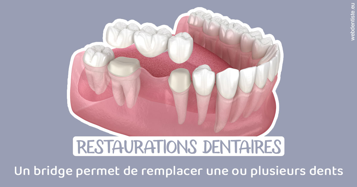 https://scp-chirurg-dentiste-drs-levy-nataf.chirurgiens-dentistes.fr/Bridge remplacer dents 1