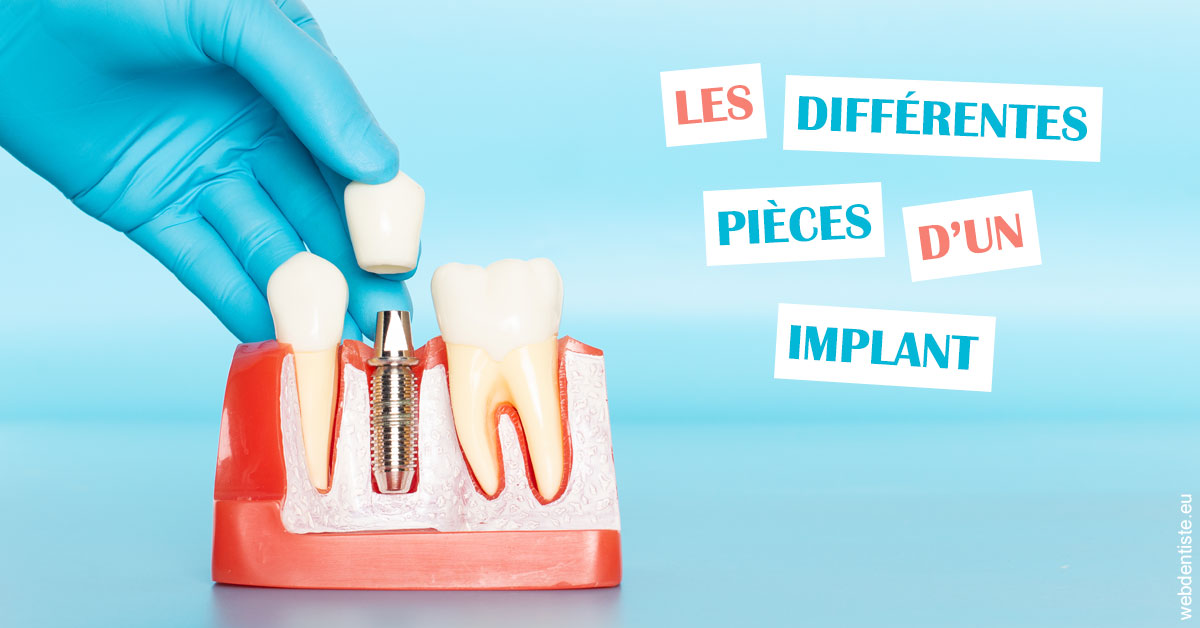 https://scp-chirurg-dentiste-drs-levy-nataf.chirurgiens-dentistes.fr/Les différentes pièces d’un implant 2