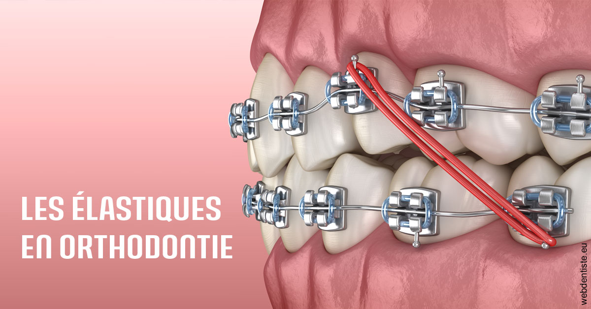 https://scp-chirurg-dentiste-drs-levy-nataf.chirurgiens-dentistes.fr/Elastiques orthodontie 2