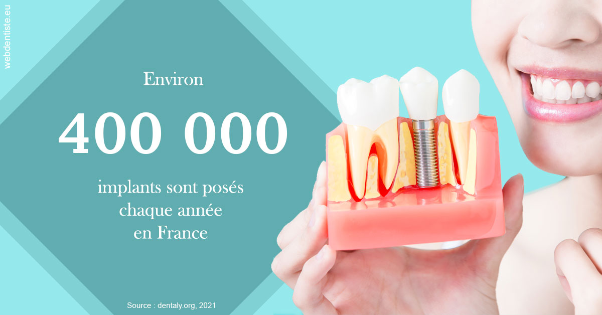 https://scp-chirurg-dentiste-drs-levy-nataf.chirurgiens-dentistes.fr/Pose d'implants en France 2